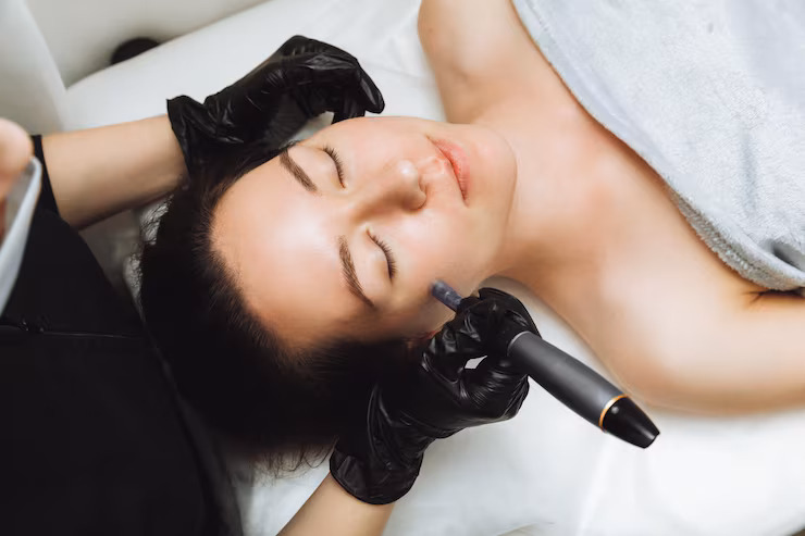 What is microneedling