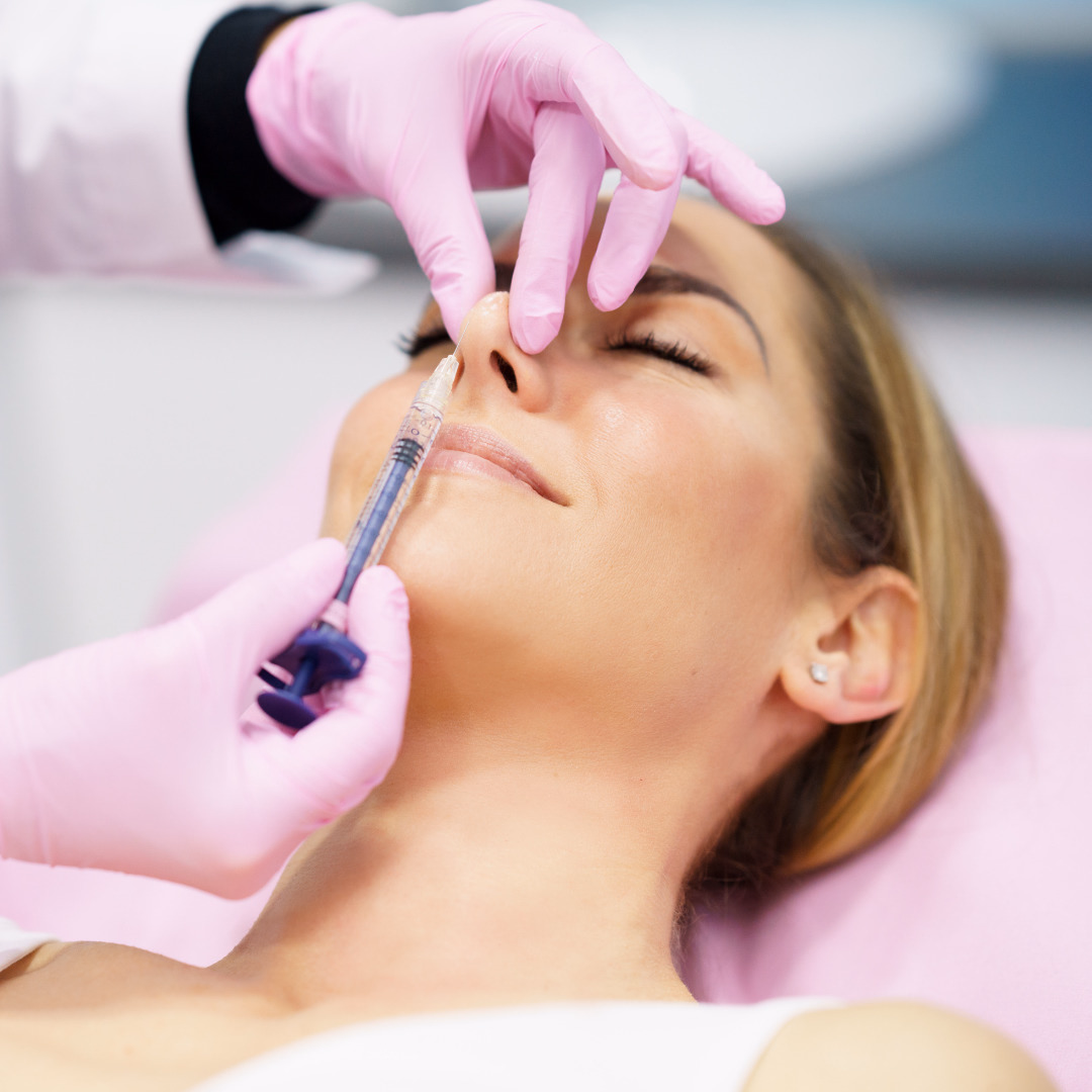 Cheek Filler