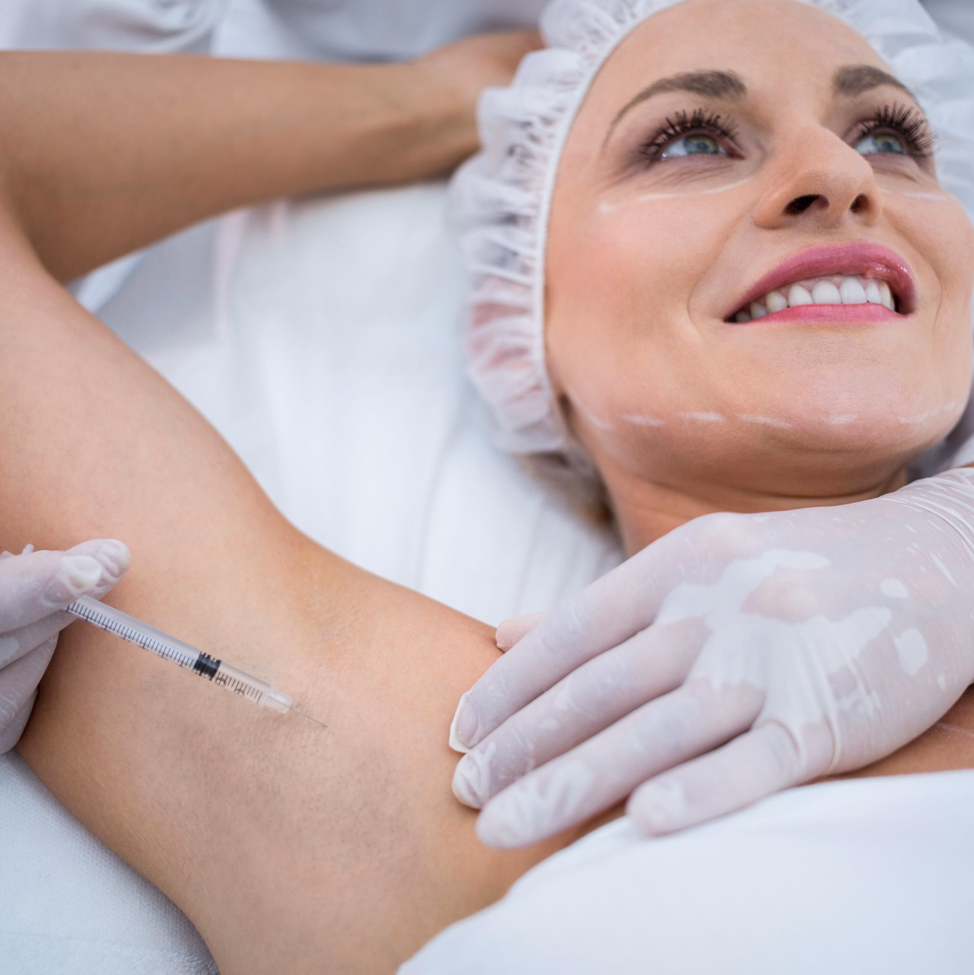 Botox for Excessive Sweating