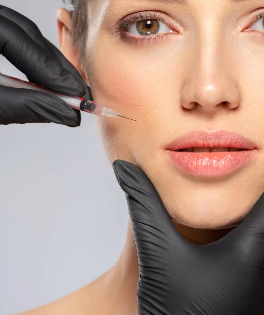 Lip Fillers