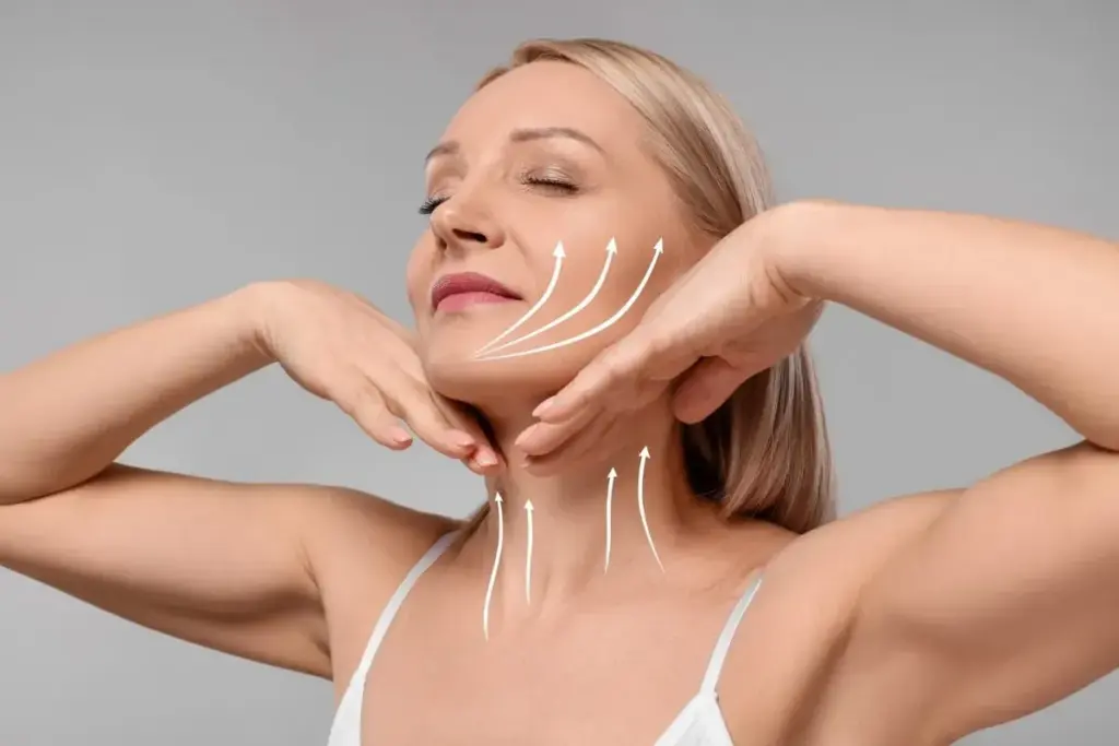 Deep Plane Facelift